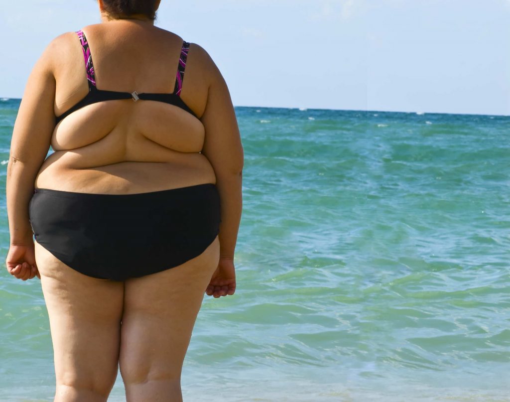 obesità menopausa